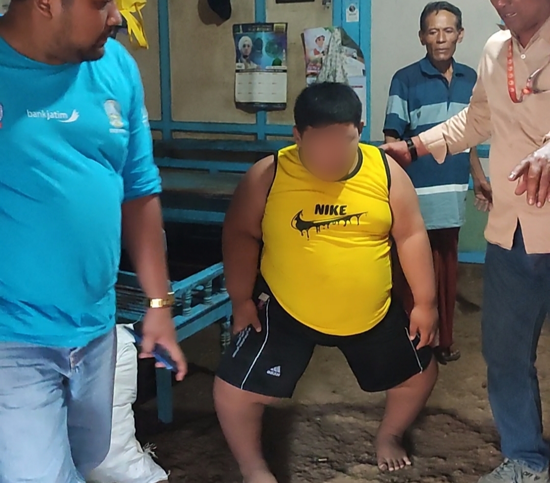 Bocah 11 Tahun Asal Tuban Obesitas Bobotnya 110 Kg, Sang Ayah Ingin Bisa Sekolah dan Bermain
